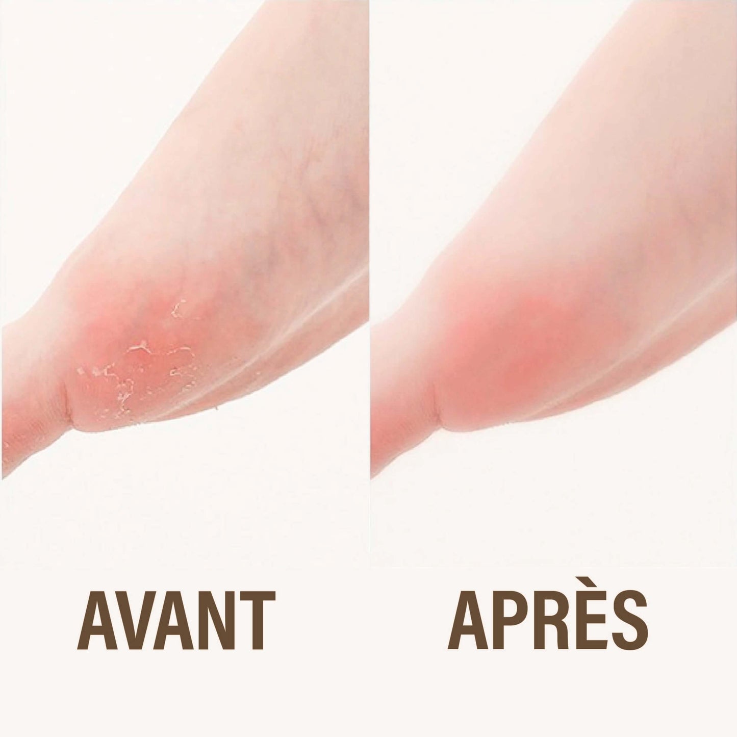Ponceuse pour pieds NesianBeauty™
